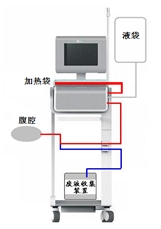 腹膜透析設備注冊審查指導原則(2024年修訂版)(2024年第19號)(圖2) 腹膜透析設備注冊審查指導原則(2024年修訂版)(2024年第19號)(圖2)